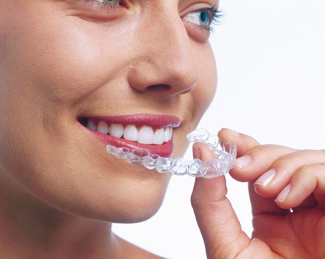 2 Invisalign