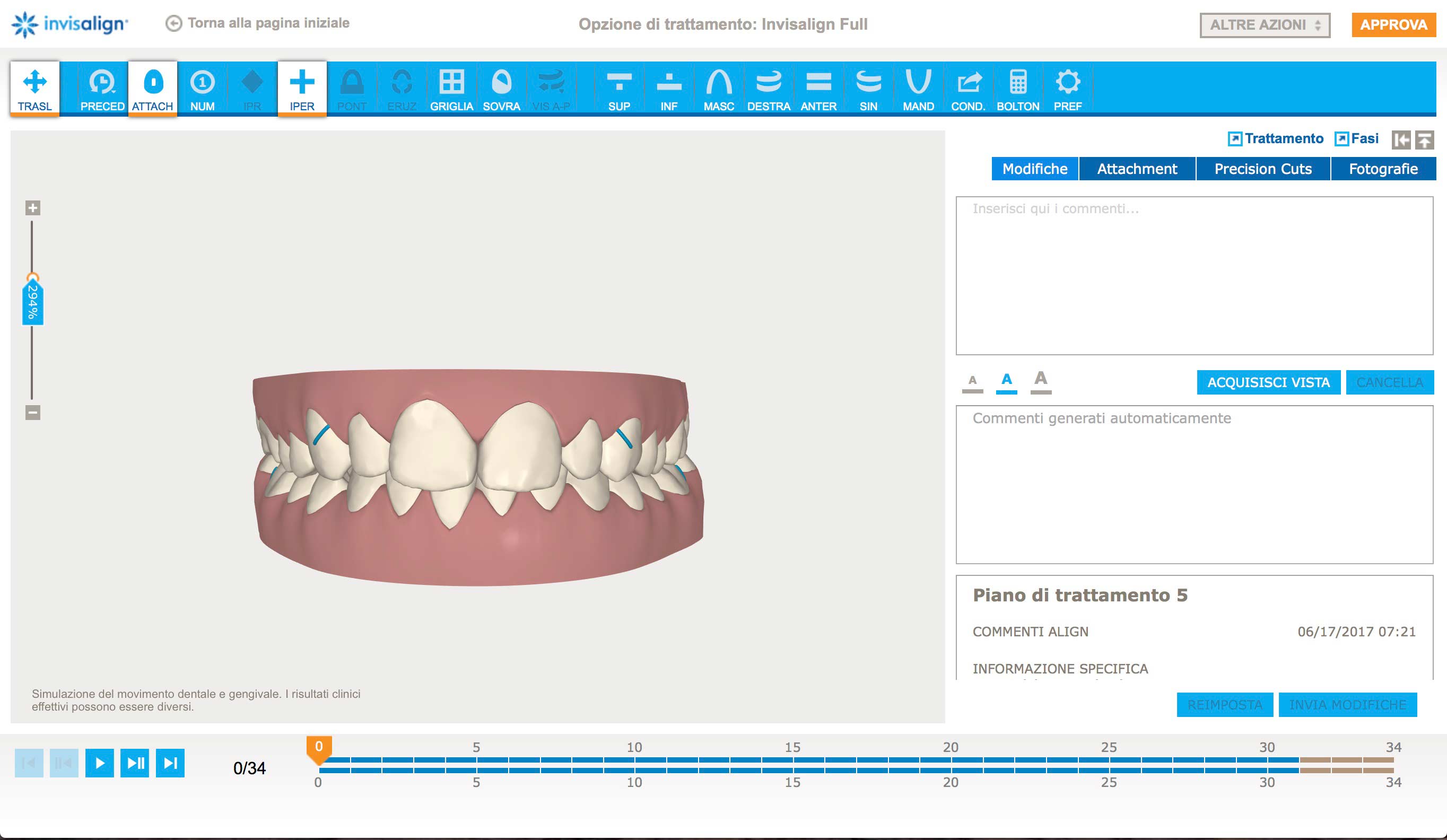 4 Invisalign3D